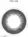 Fig. 12 - CONTACT LENS WITH IMPROVED, MULTIPLE AND INTEGRATED EFFECTS