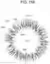 Fig. 14 - CONTACT LENS WITH IMPROVED, MULTIPLE AND INTEGRATED EFFECTS