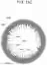 Fig. 15 - CONTACT LENS WITH IMPROVED, MULTIPLE AND INTEGRATED EFFECTS