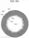 Fig. 19 - CONTACT LENS WITH IMPROVED, MULTIPLE AND INTEGRATED EFFECTS