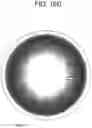 Fig. 20 - CONTACT LENS WITH IMPROVED, MULTIPLE AND INTEGRATED EFFECTS