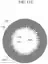 Fig. 23 - CONTACT LENS WITH IMPROVED, MULTIPLE AND INTEGRATED EFFECTS