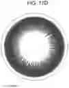 Fig. 24 - CONTACT LENS WITH IMPROVED, MULTIPLE AND INTEGRATED EFFECTS