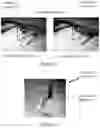 Fig. 09 - APPARATUS AND METHOD FOR FITTING HEAD MOUNTED VISION AUGMENTATION SYSTEMS