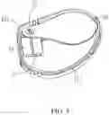 Fig. 04 - LENS SCREENING DEVICE