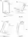 Fig. 04 - FLASH DEVICE SYSTEM