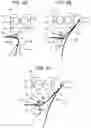 Fig. 05 - Image forming apparatus capable of preventing a regulation member from being broken or slipping off when a jammed sheet is removed from a transfer portion