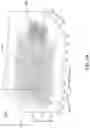 Fig. 09 - Unsupervised defect segmentation