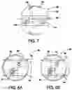 Fig. 06 - Tether for an inspection vehicle