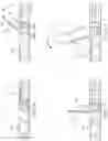 Fig. 10 - STACKING DETACHABLE TABLET