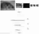 Fig. 05 - Gaze point compensation method and apparatus in display device, and display device