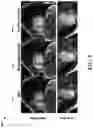 Fig. 07 - Forward and reverse transformations of a model of functional units of a biological system trained by a global model of the systems