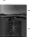 Fig. 01 - Lane marker detection and lane instance recognition