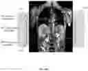 Fig. 13 - Systems and methods for determining a region of interest of a subject