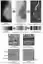 Fig. 09 - System and method for the visualization and characterization of objects in images