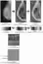 Fig. 11 - System and method for the visualization and characterization of objects in images