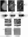 Fig. 17 - System and method for the visualization and characterization of objects in images