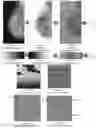 Fig. 21 - System and method for the visualization and characterization of objects in images