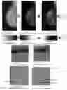 Fig. 24 - System and method for the visualization and characterization of objects in images