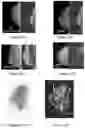 Fig. 28 - System and method for the visualization and characterization of objects in images