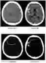 Fig. 38 - System and method for the visualization and characterization of objects in images