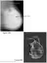 Fig. 45 - System and method for the visualization and characterization of objects in images