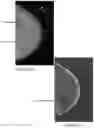 Fig. 46 - System and method for the visualization and characterization of objects in images