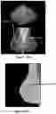 Fig. 47 - System and method for the visualization and characterization of objects in images