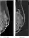 Fig. 48 - System and method for the visualization and characterization of objects in images