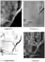 Fig. 49 - System and method for the visualization and characterization of objects in images