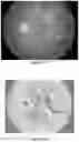 Fig. 52 - System and method for the visualization and characterization of objects in images
