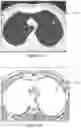 Fig. 53 - System and method for the visualization and characterization of objects in images