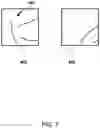 Fig. 09 - Pixel error detection system
