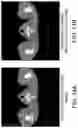 Fig. 15 - X-ray CT scanner, image generation method, and image generation program