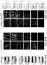 Fig. 15 - Methods, systems, and apparatuses for quantitative analysis of heterogeneous biomarker distribution