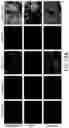 Fig. 20 - Methods, systems, and apparatuses for quantitative analysis of heterogeneous biomarker distribution