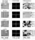 Fig. 25 - Methods, systems, and apparatuses for quantitative analysis of heterogeneous biomarker distribution