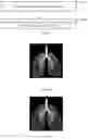Fig. 03 - Method and device for state display during ventilation process