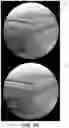 Fig. 06 - Deformed grid based intra-operative system and method of use