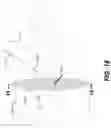 Fig. 17 - Surgeon head-mounted display apparatuses