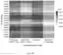 Fig. 11 - MHC-1 Genotypes Restricts The Oncogenic Mutational Landscape
