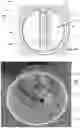 Fig. 33 - Medication adherence apparatus and methods of use