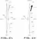 Fig. 03 - Operatively tuning implants for increased performance