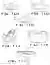 Fig. 08 - Operatively tuning implants for increased performance