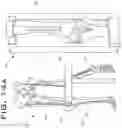 Fig. 10 - Operatively tuning implants for increased performance