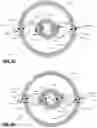 Fig. 06 - Metal contamination reduction in substrate processing systems with transformer coupled plasma