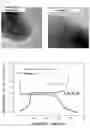 Fig. 03 - Lithium metal oxide, negative electrode active material for lithium secondary battery comprising the same, and method of preparing the same