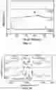 Fig. 06 - ELECTROSPUN COMPOSITE SEPARATOR FOR ELECTROCHEMICAL DEVICES AND APPLICATIONS OF SAME