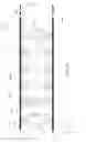 Fig. 06 - Electromagnetic actuator for artificial muscle fibers and a method of manufacture thereof
