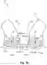 Fig. 05 - Multiple arm dipole antenna for hearing instrument